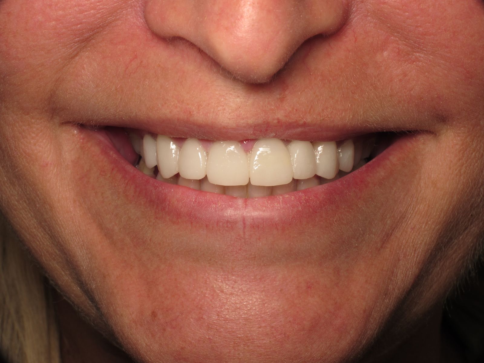 Cosmetic Dentistry Harrisonville, MO Custom Dental of Harrisonville